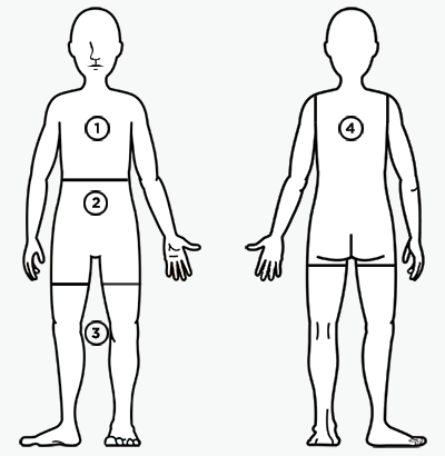 Image of body with four numbers. Number one corresponds to neck, chest, and arms. Numnber two corresponds to abdomen, hips, and groin. Number three corresponds to both legs, front and back. Number four corresponds to back and outer buttocks.