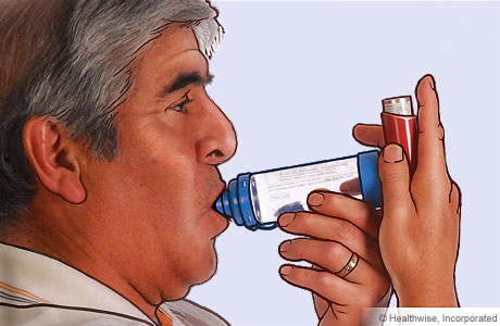Picture of a man placing the spacer mouthpiece in his mouth