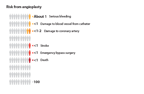 Out of 100 people who have angioplasty, about 1 will have serious bleeding or damage to a blood vessel from the catheter; about 1 to 2 will have damage to the coronary artery; about 1 will have a stroke or need emergency bypass surgery; and about 1 will die.