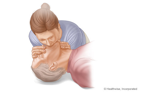 CPR on adult, showing rescue breathing