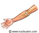 The bones of the elbow
