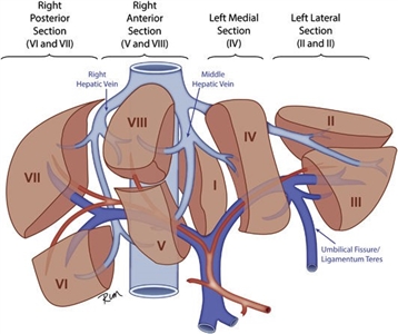 Figure showing 4 sections of the liver: the right posterior section, the right anterior section, the left medial section, and the left lateral section. The boundaries of each section are defined by the right hepatic vein, the middle hepatic vein, and the umbilical fissure/ligamentum teres. Also shown are 8 anatomic segments (I-VIII), each corresponding to a specific section of the liver.